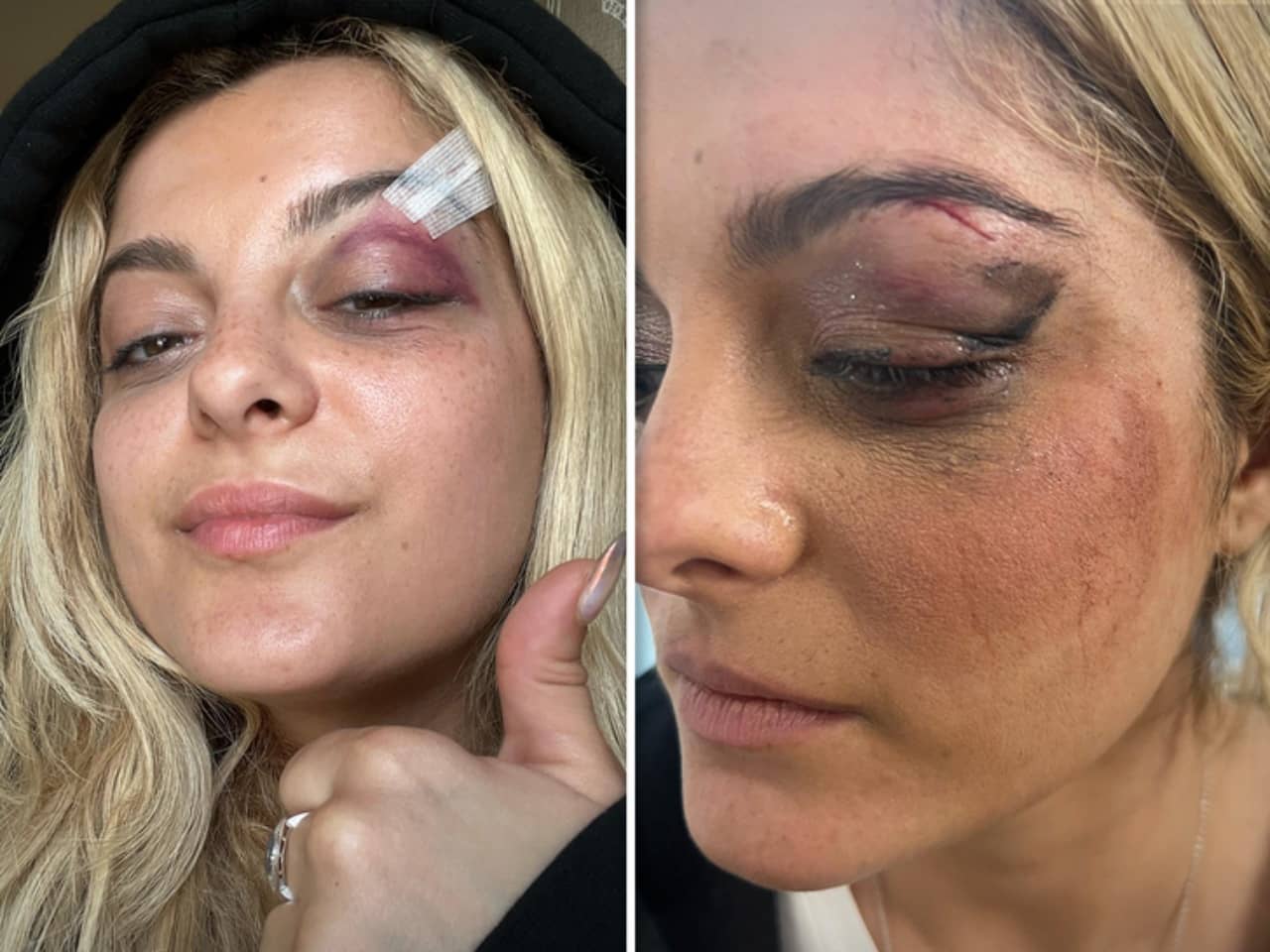 Bebe Rexha, NYC Konserinde Cep Telefonu İle Saldırı Yaşadı